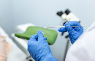 Cervical Screening
