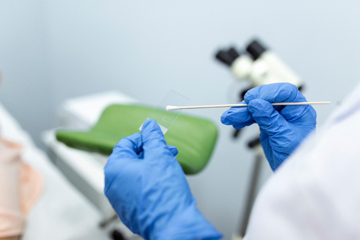 suttoncrossfamilypractice-cervical-screening